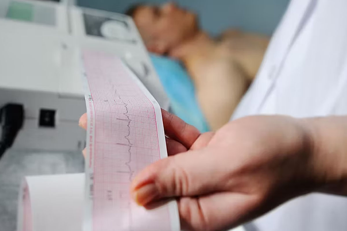 Klasyfikacja stabilnej choroby wieńcowej