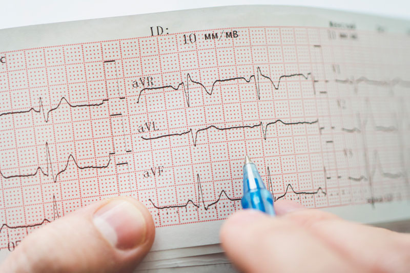 Rodzaje, objawy i rozpoznawanie zawału serca oraz powikłania
